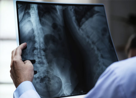 Düşme ve yaralanma riski altında mısınız?